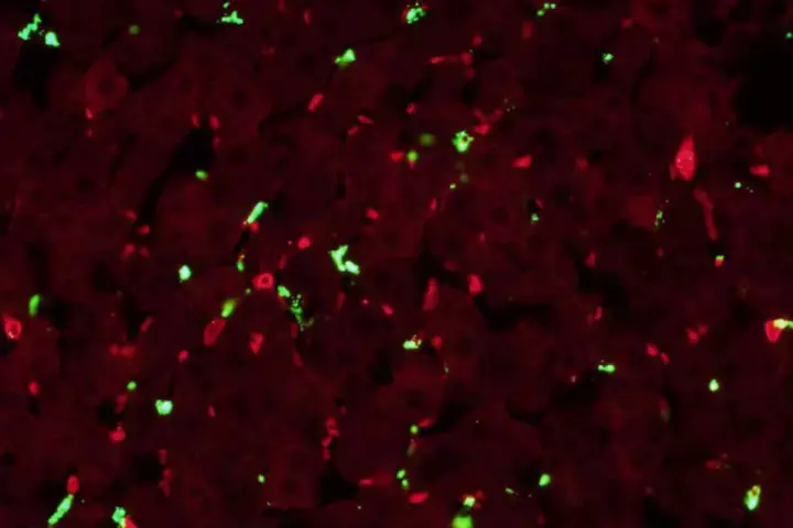 The nanoparticles (green) distract the immune cells (red) from causing unwanted inflammation