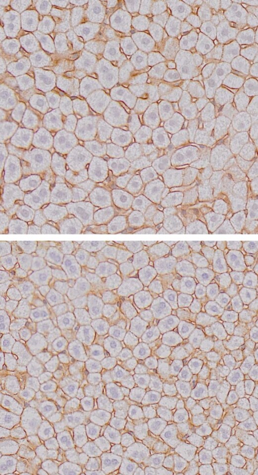 Liver cells at the end of the night (top), after the mice had been feeding compared to liver cells during the day (bottom)