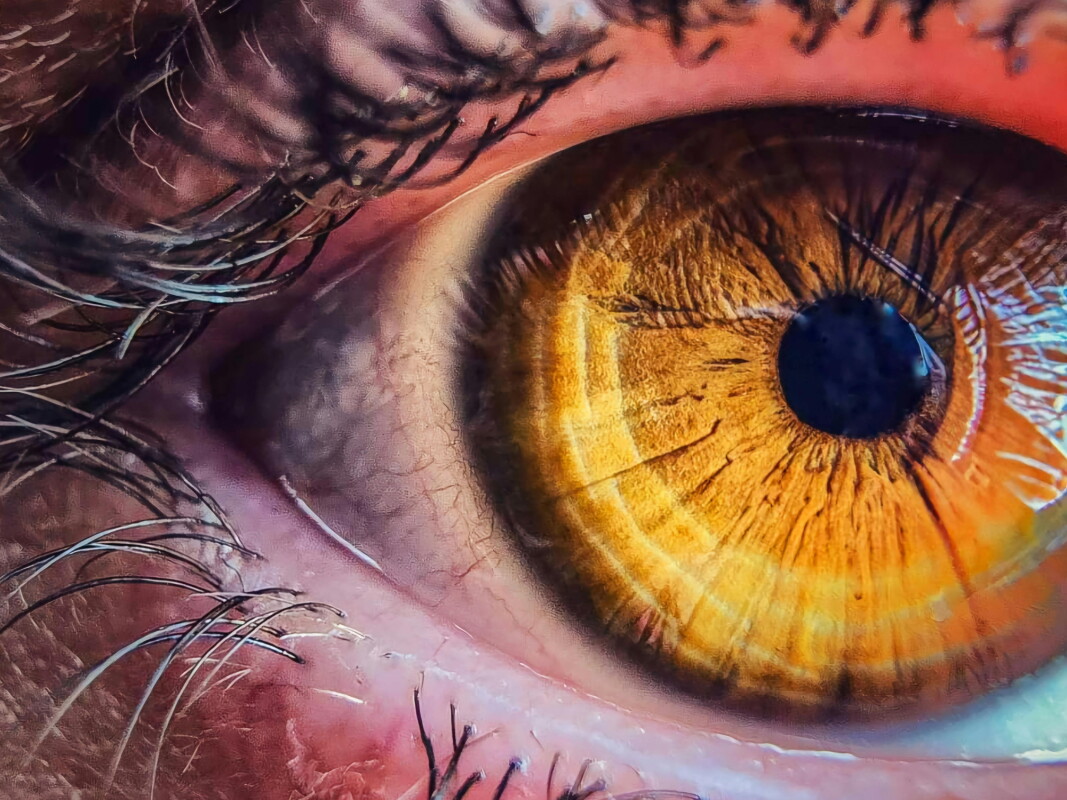 Daylight saving could affect your risk of developing eye disease