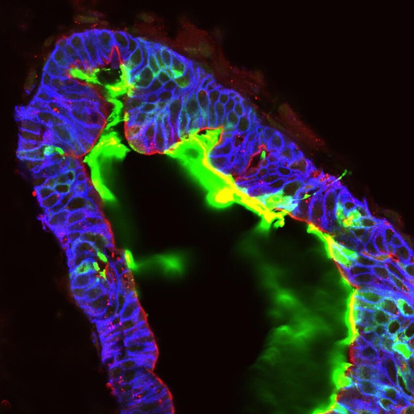 Intestinal epithelium expressing and secreting Mucin (green) into the organoid lumen (Image: Jason Spence)
