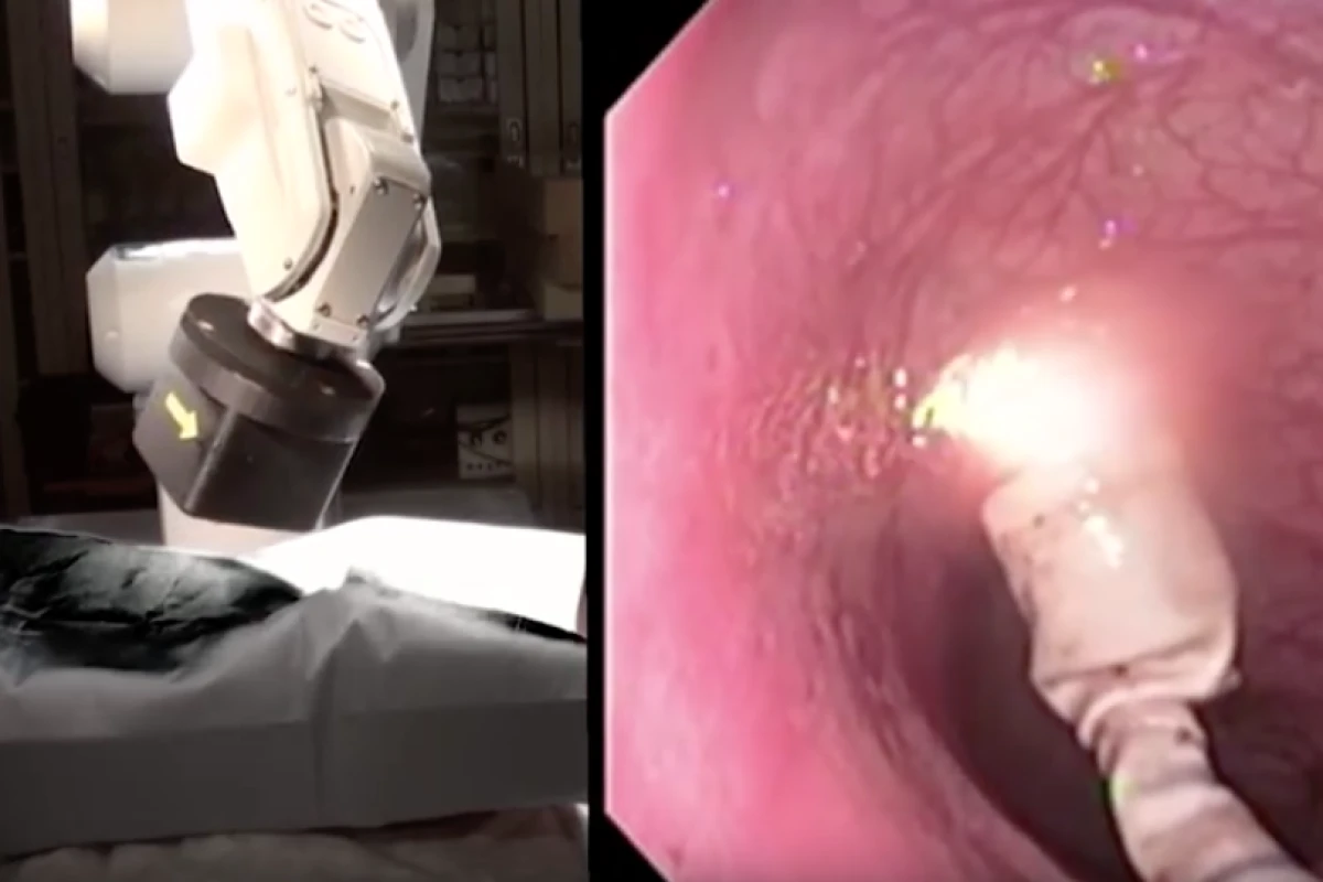 The capsule on the right is directed by a robotically controlled magnetic arm, as seen on the left