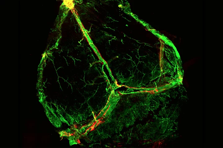 The new observations confirmed the existence of meningeal lymphatic vessels (red) around the meningeal blood vasculature (green)