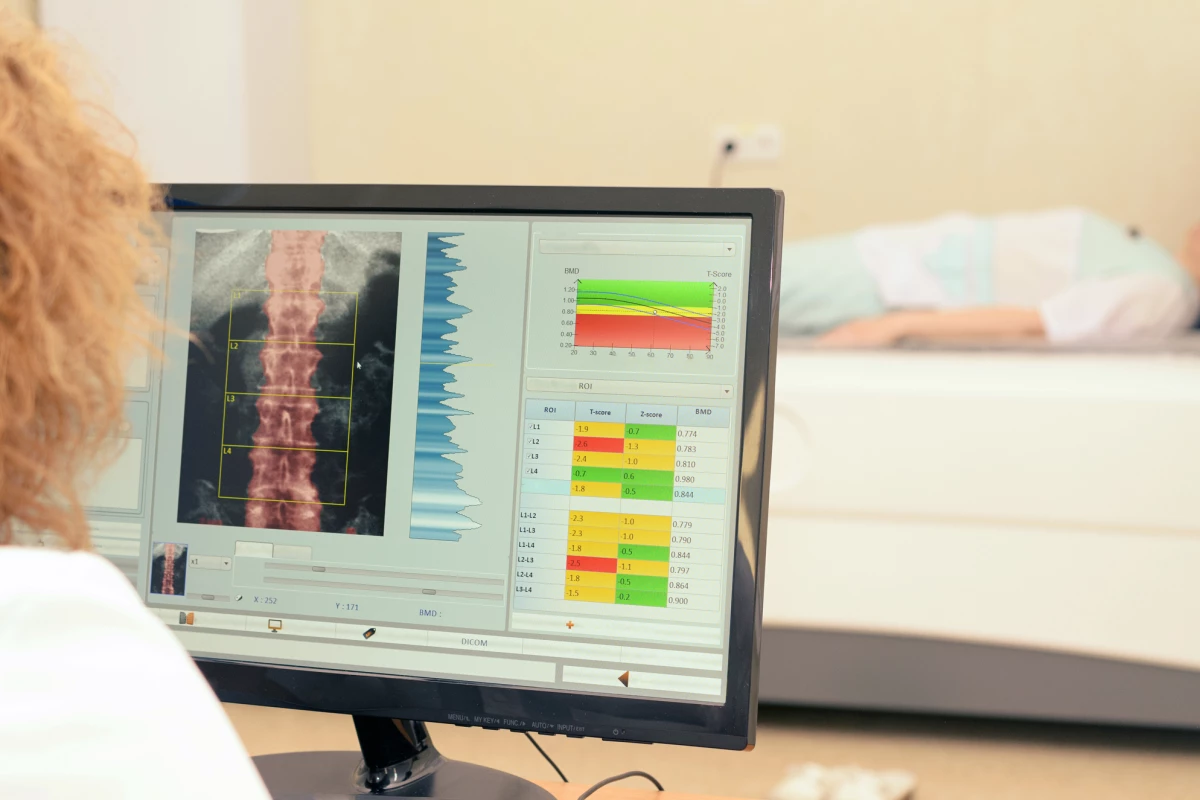 Researchers have analyzed bone density scans using a machine learning algorithm to predict future cardiovascular disease