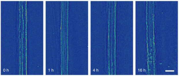 X-ray images of the anode show a smooth surface of lithium