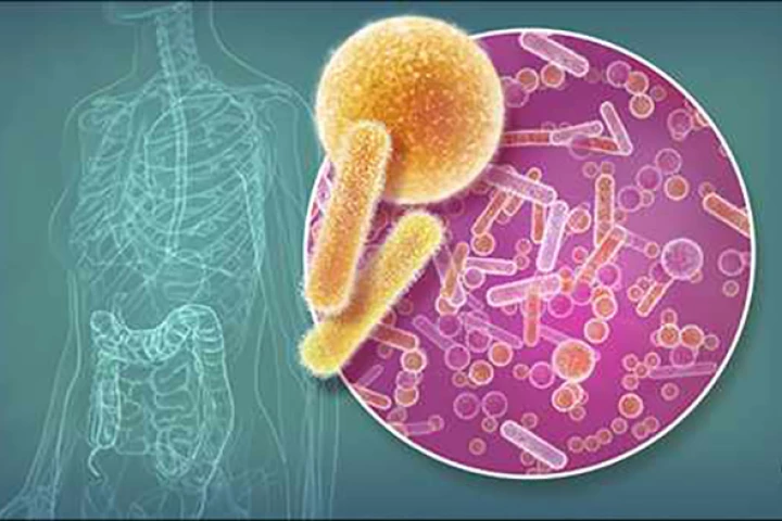 The newly discovered microbe is called Prevotella histicola and could one day be used to treat multiple sclerosis