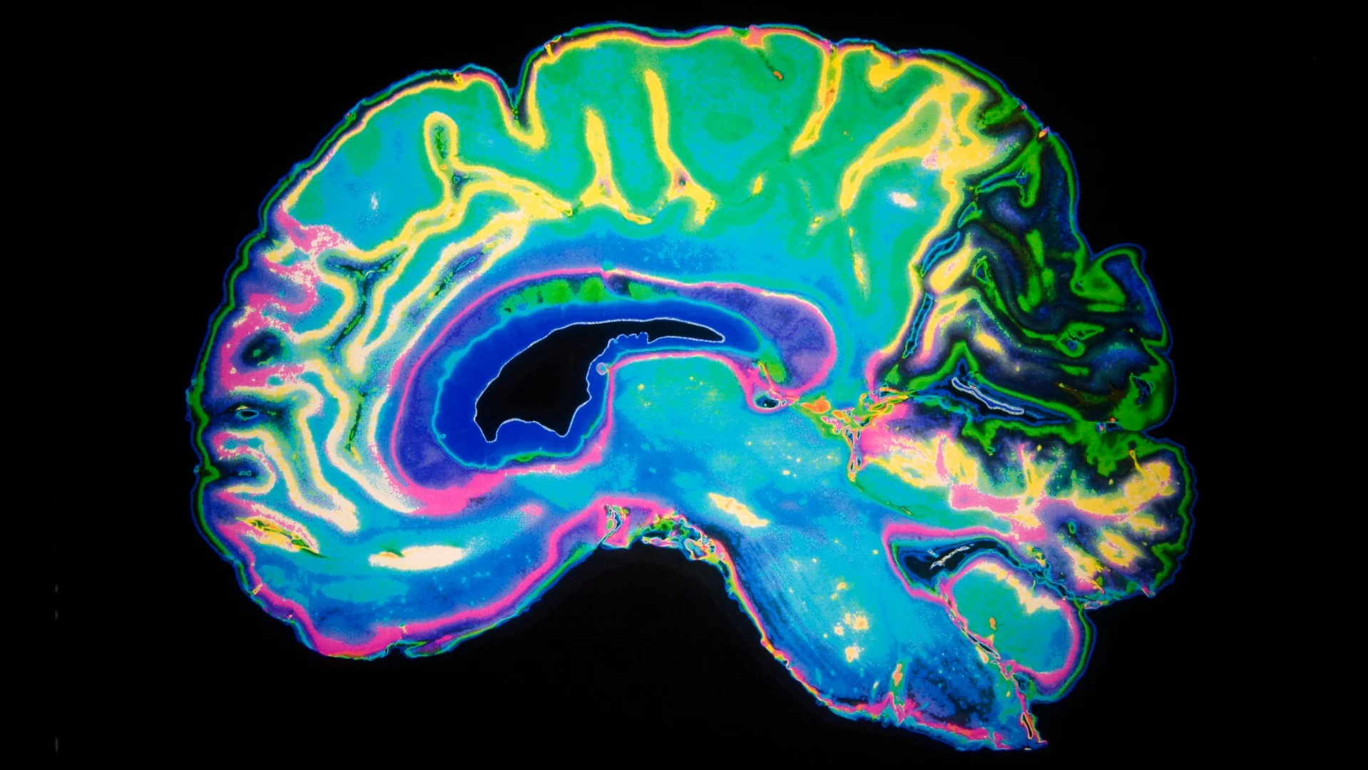 A new technique may be able to decode brain waves to infer what mood a patient is in, which could eventually be used to better time treatments of depression and anxiety