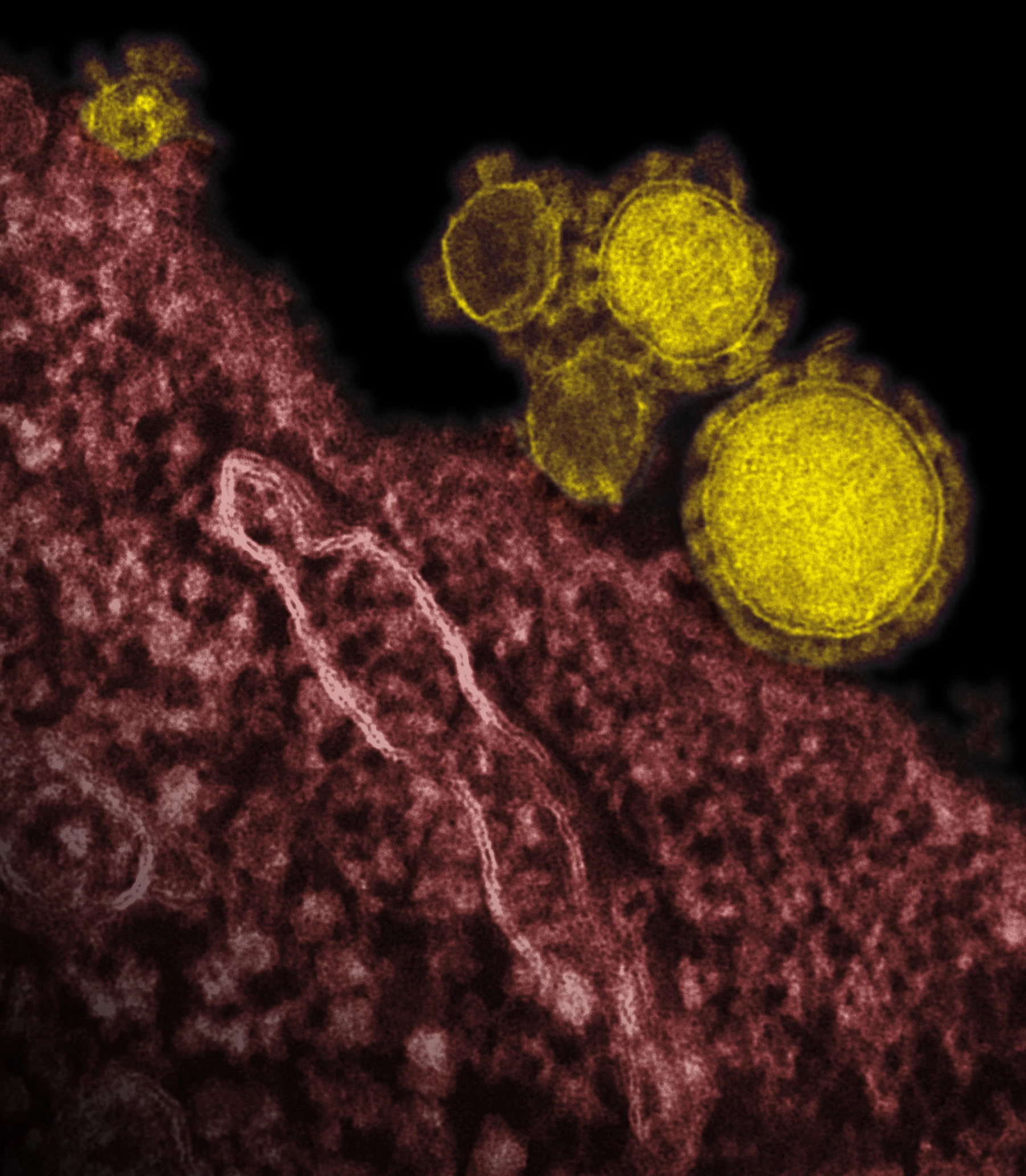 An image from 2012 of the MERS virus, another member of the coronavirus family