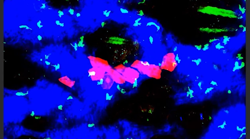 TRM cells (in light green) surrounding and keeping the melanoma cells (in red) in check