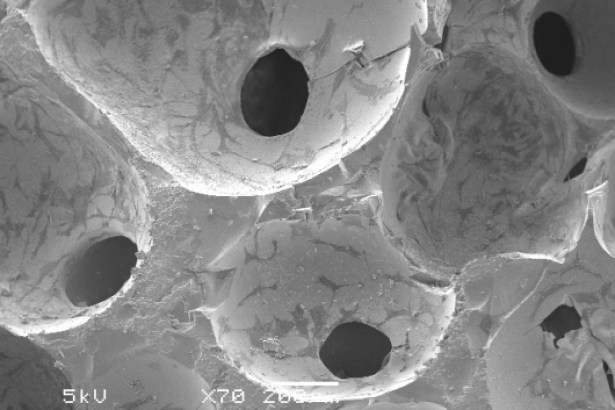 Bone cells grown on bioactive glass after two weeksImage courtesy Imperial College