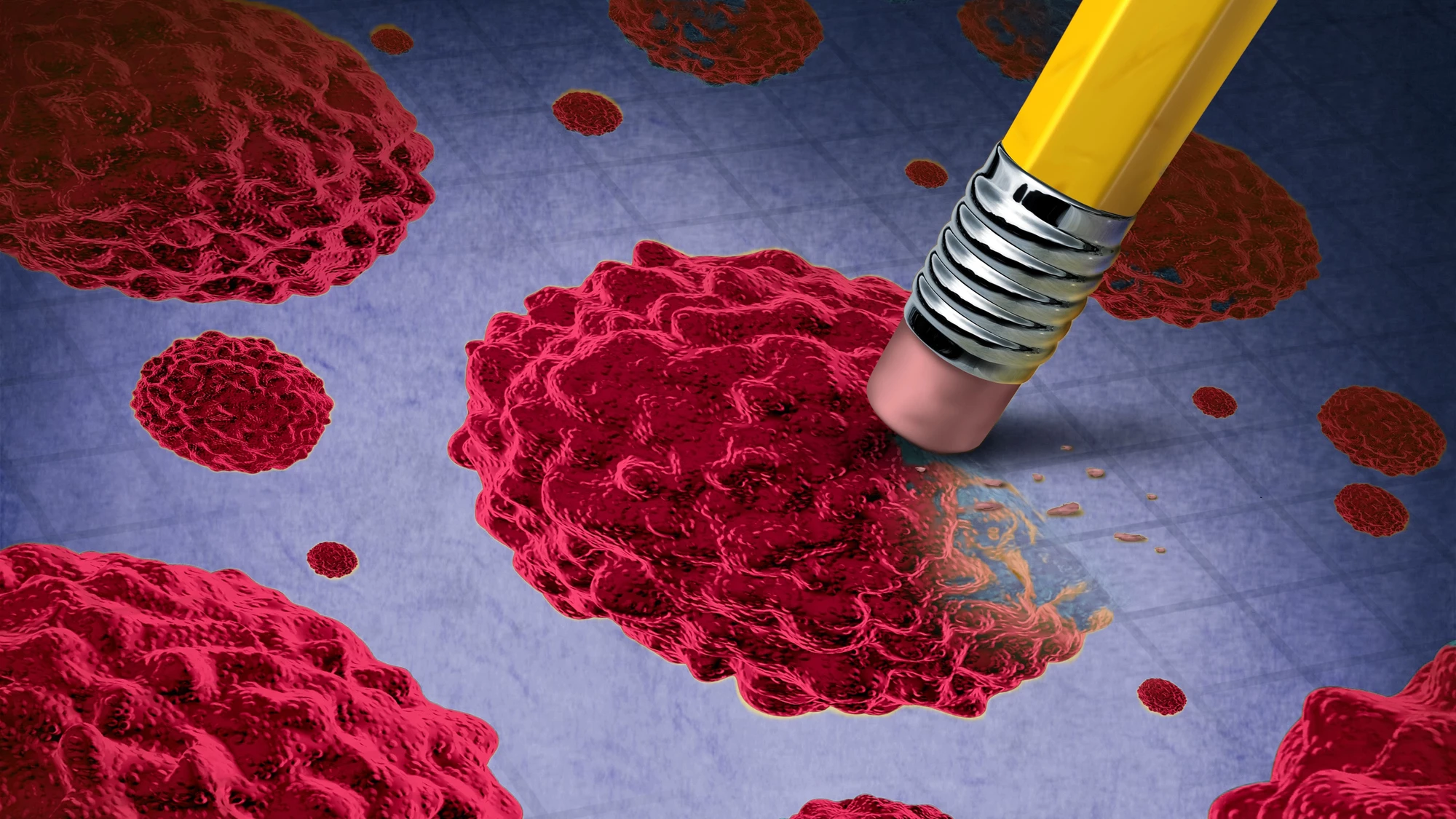 Adding an immunotherapy drug to chemotherapy made breast cancer treatment more effective