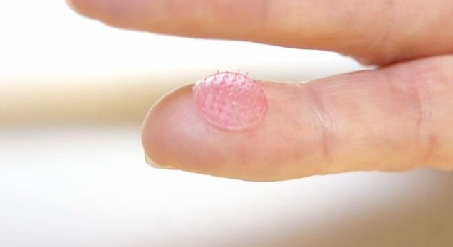 The arrays were made up of sucrose mixed with a dried version of a live modified adenovirus-based candidate HIV vaccine