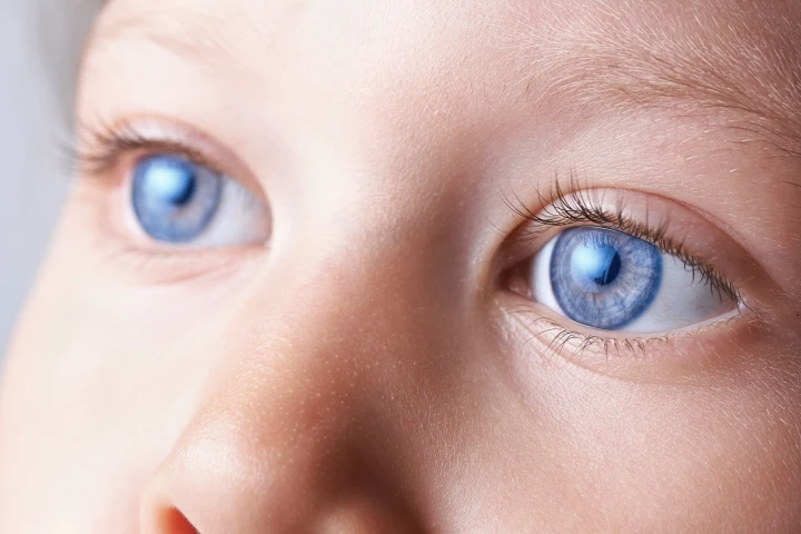 An inability to suppress eye movement could be a reliable indicator of ADHD (Photo: Shutterstock)