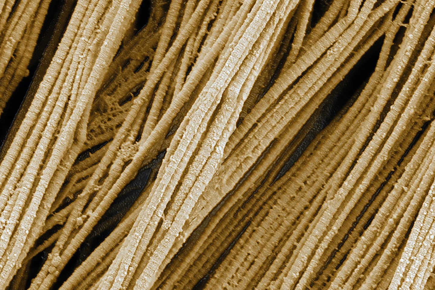 Scanning electron microscopy of collagen fibers