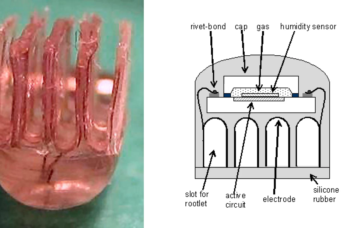 The active electrode book - the four slots close in around the nerve roots like the pages of a book