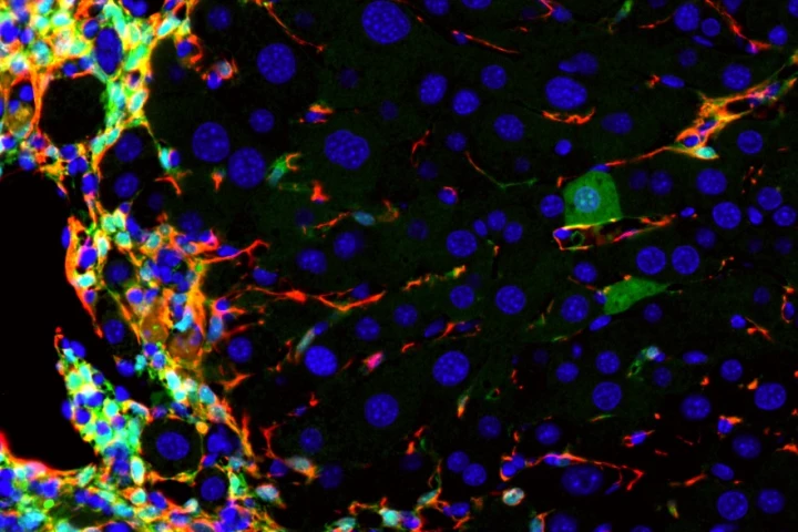 A section of mouse liver that shows liver disease in red being converted into healthy new liver cells in green