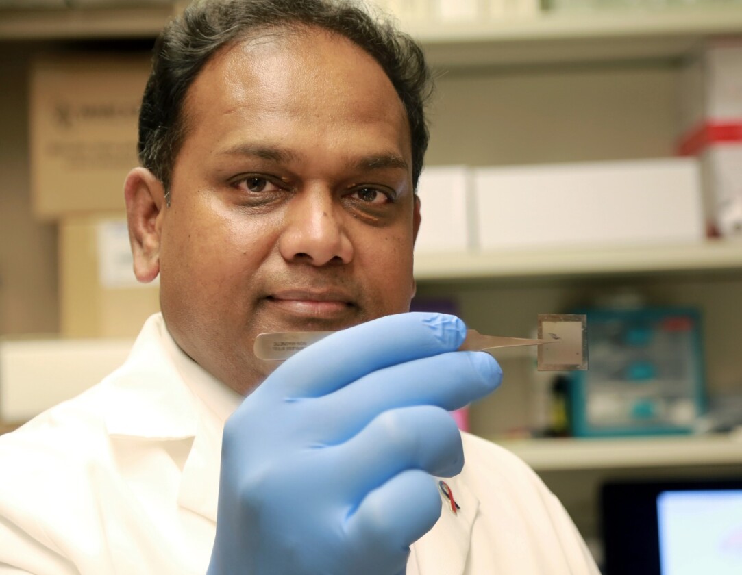 Chandan Sen, first author of the research, with the Tissue Nanotransfection chip
