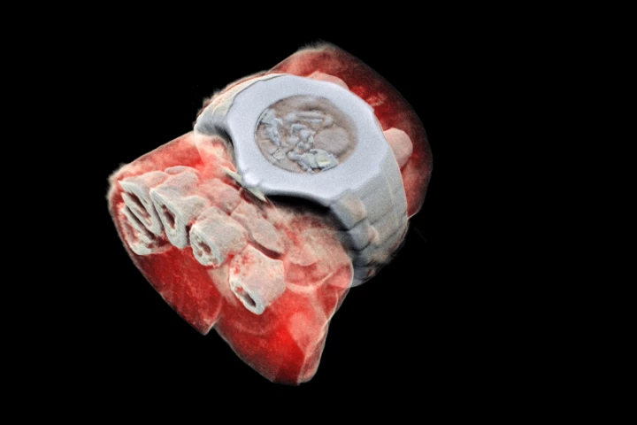 Using CERN technology, Mars Bioimaging has created the first 3D, color X-ray images of the human body