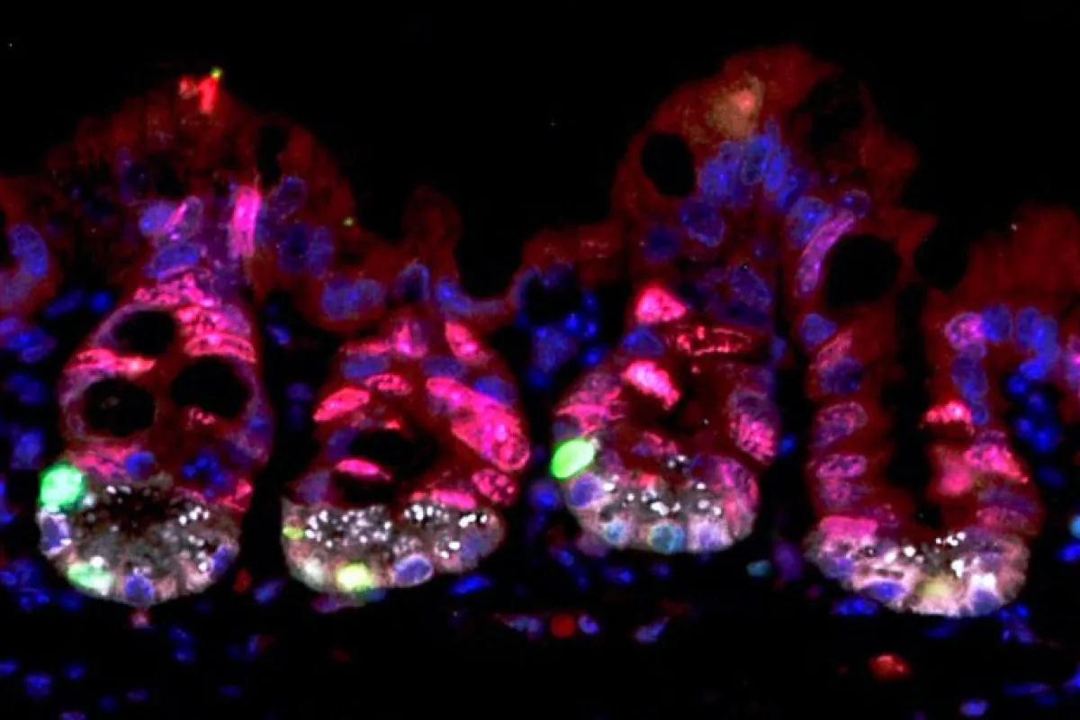 The red cells are proliferating cells in the intestinal crypts, which are vulnerable to radiation damage. The green ones however are dormant and have high levels of URI, protecting them from damage