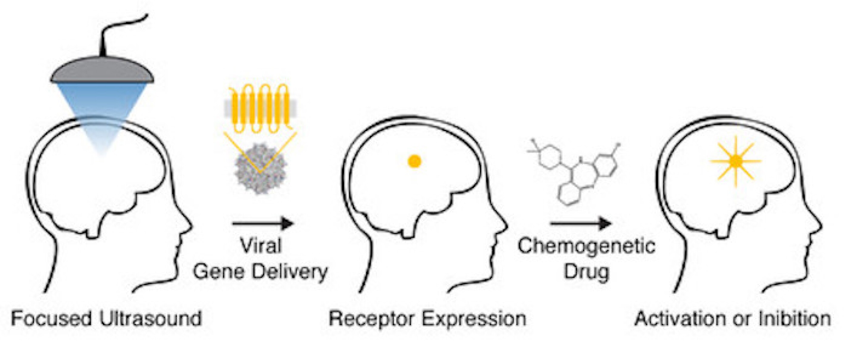 How combining ultrasound, gene therapy and drugs switches neurons on