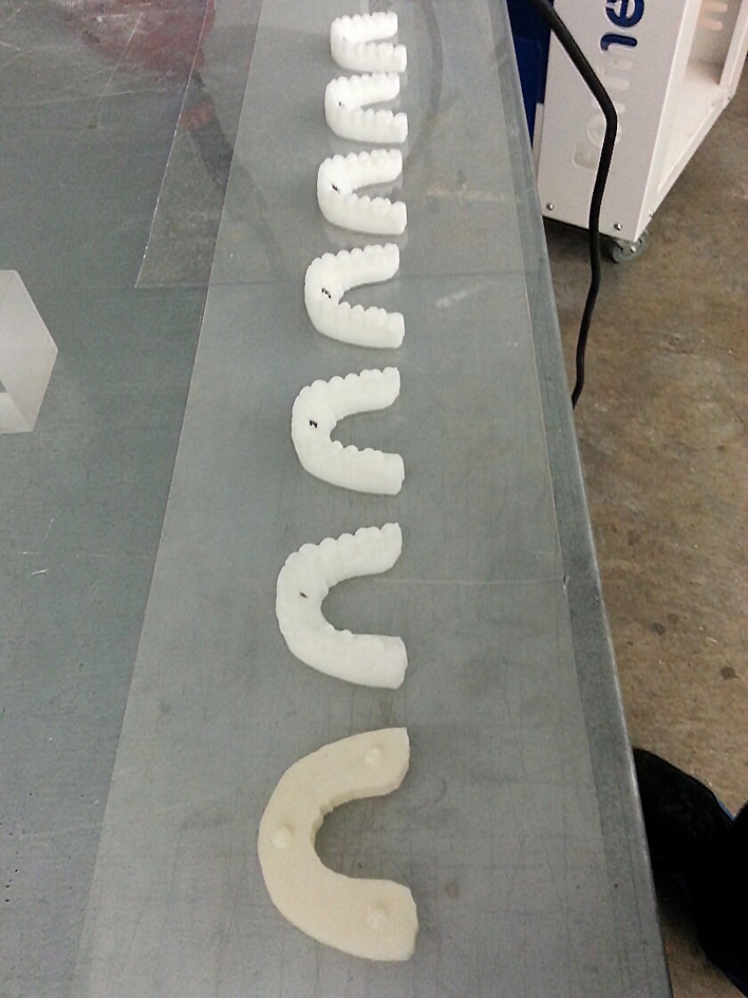 After making the molds of each step in the alignment, Dudley used a vacuum forming machine and dental plastic to create his pathway to the perfect smile