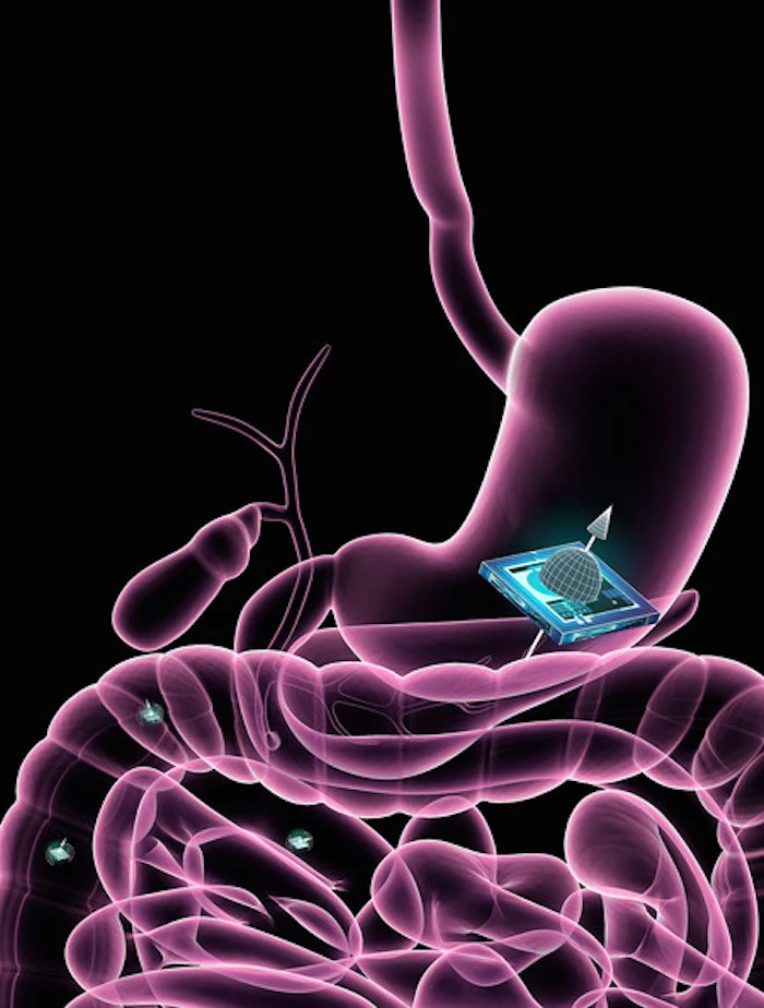 The ATOMS chip can ping its location in the body in response to an MRI scan, allowing doctors to one day keep track of medical nanobots inside patients