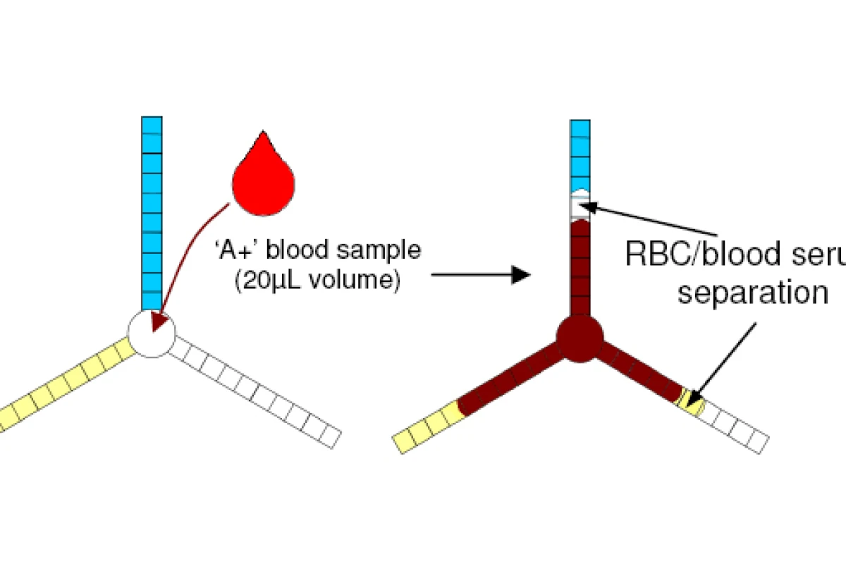 Example of test results for the A blood group