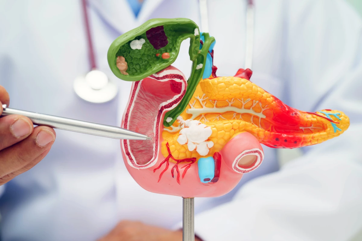 A new protein discovery could lead to more effective treatments for one of the deadliest cancers