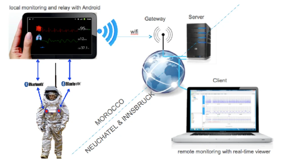 Long-term medical monitoring system LTSM (Image: CSEM)