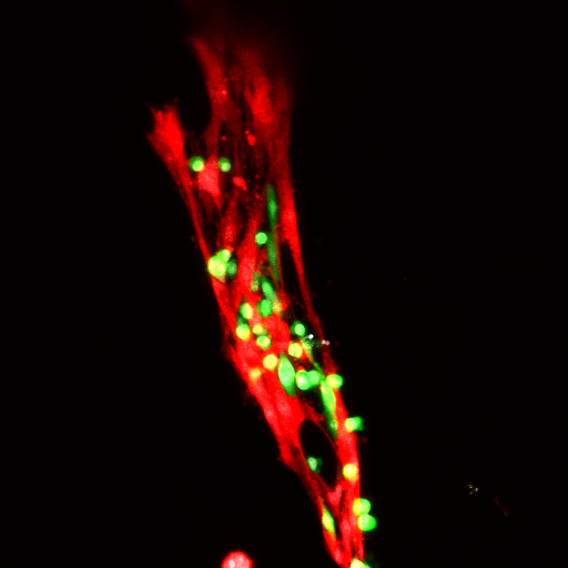 Muscle satellite cells (green) attached to a damaged muscle strand by the team's new hydrogel treatment