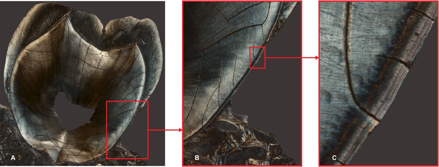 Close-up views of one of the teeth, showing clear darker lines in the cementum around the ages that the owner had their two children