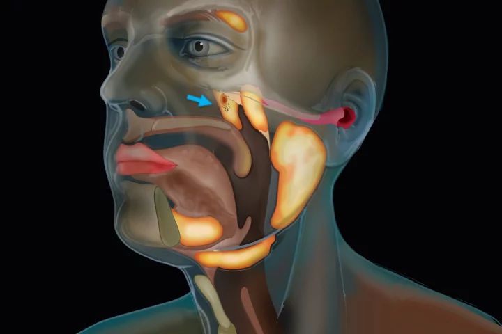 The newly discovered salivary glands should help doctors reduce the volume of negative side effects seen from head and neck cancer radiotherapy