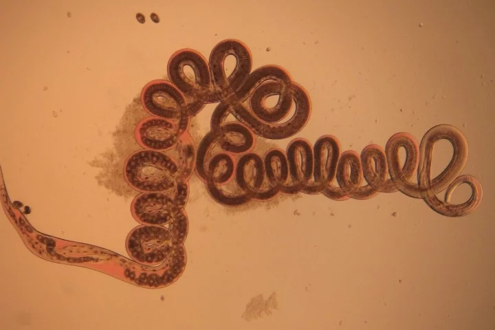 This parasitic worm, Heligmosomoides polygyrus, has been found to reduce incidences of obesity in mouse experiments