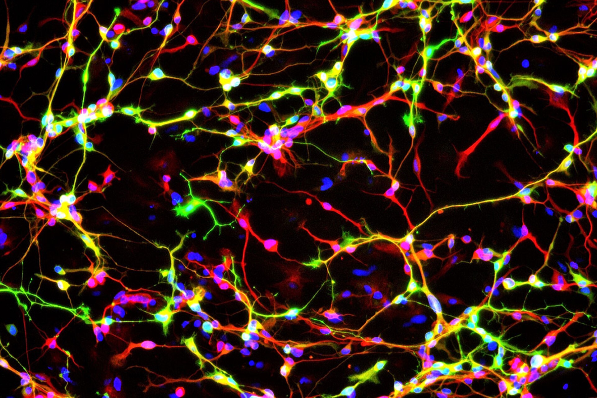 New Adult-Born Neuron IMAGE EurekAlert! Science News Releases