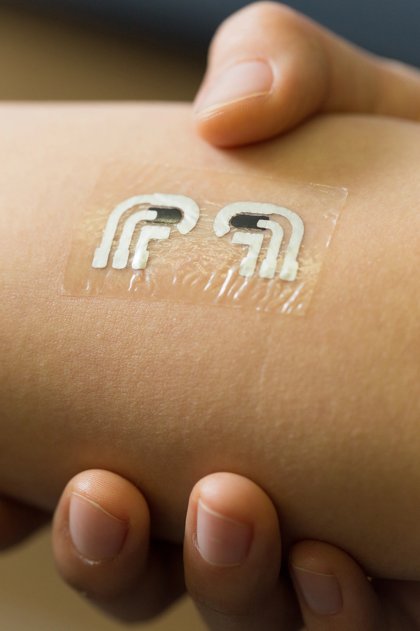 The tattoo measures glucose levels in fluid between the skin cells, which reflects levels in the bloodstream
