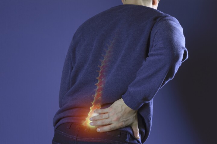 Navitoclax knocked out pain-triggering senescent osteoclasts to relieve back pain