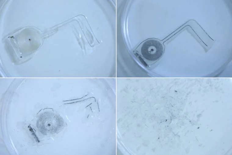 The device dissolving over 25 days