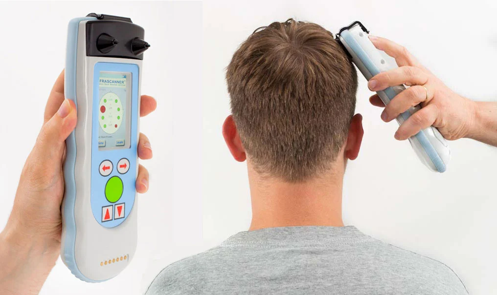The Infrascanner Model 2000 is a handheld device that uses near infra-red light to detect traumatic brain injuries