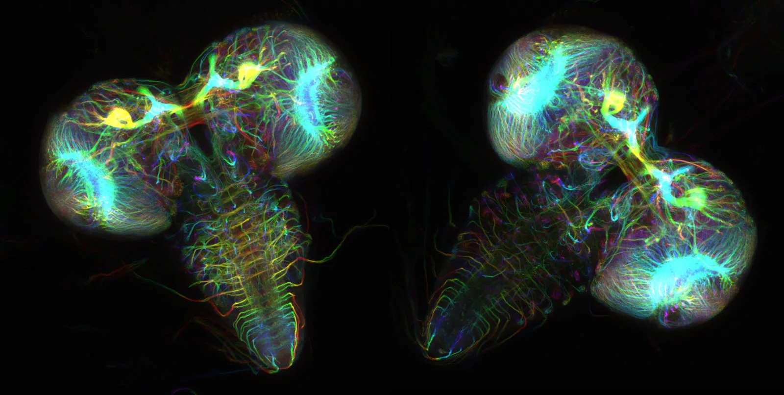 Image of Distinction: Fruit fly larval brains