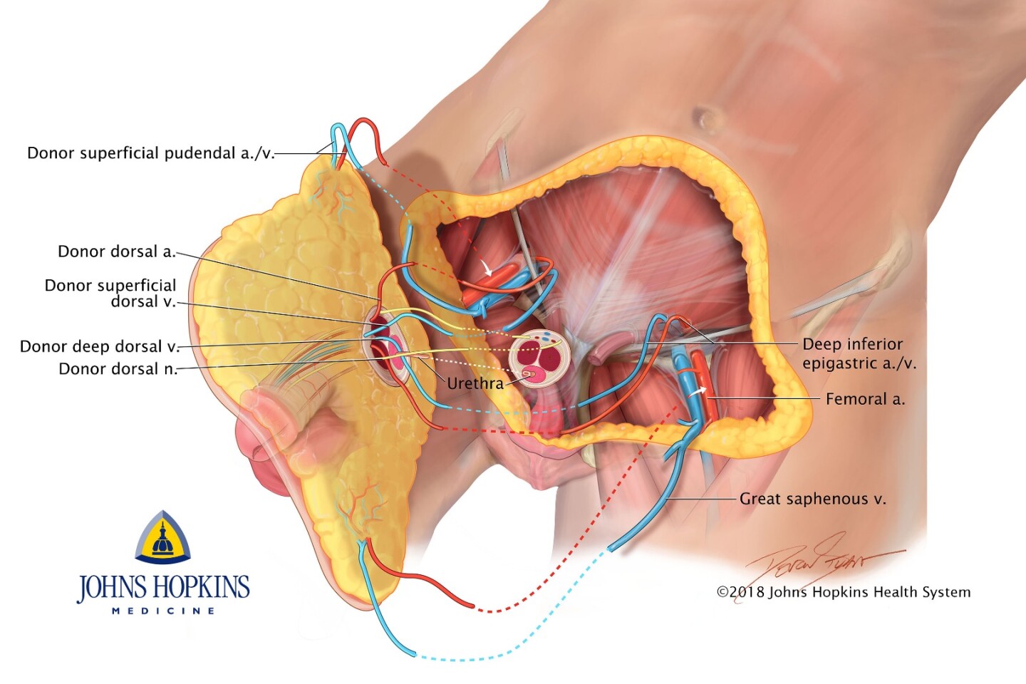 Diagram illustrating the donated body parts
