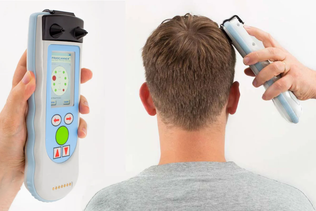 The Infrascanner Model 2000 is a handheld device that uses near infra-red light to detect traumatic brain injuries