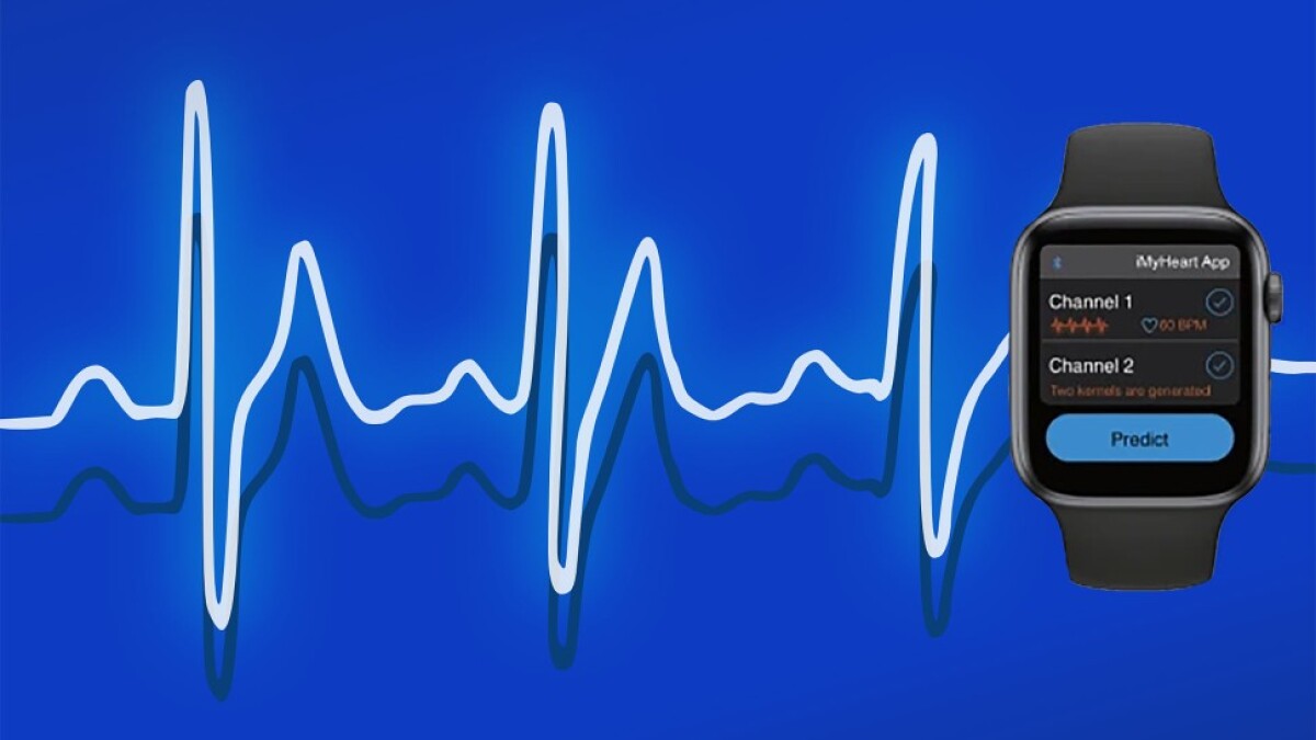 Ultra-efficient machine learning transistor cuts AI energy use by 99%