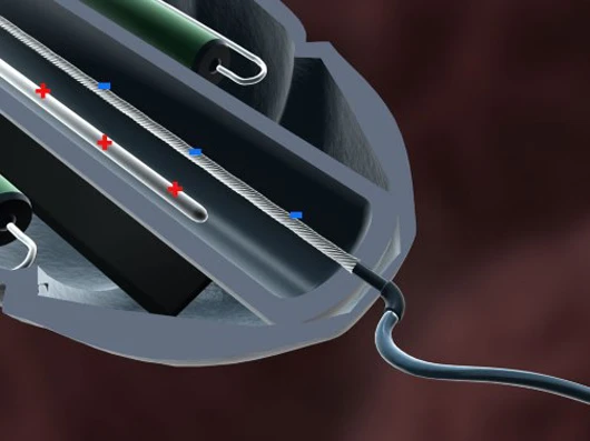 Scientists have created a tiny artificial muscle, that could be used in motors to propel nanobots inside the human body (Image: University of Wollongong)