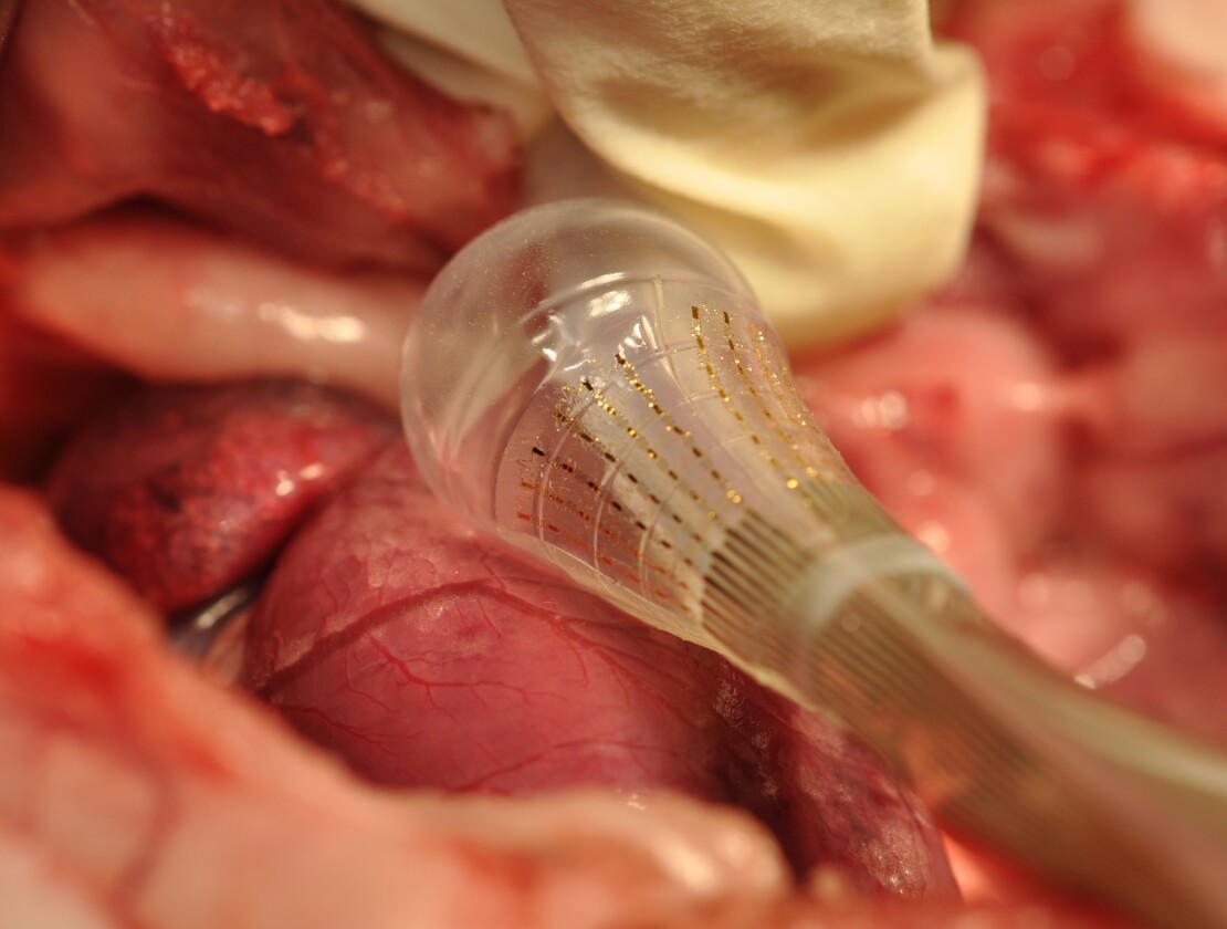 The endocardial balloon catheter with a stretchable array of sensors and electrodes, designed to treat arrhythmias (Photo: Kevin Dowling)