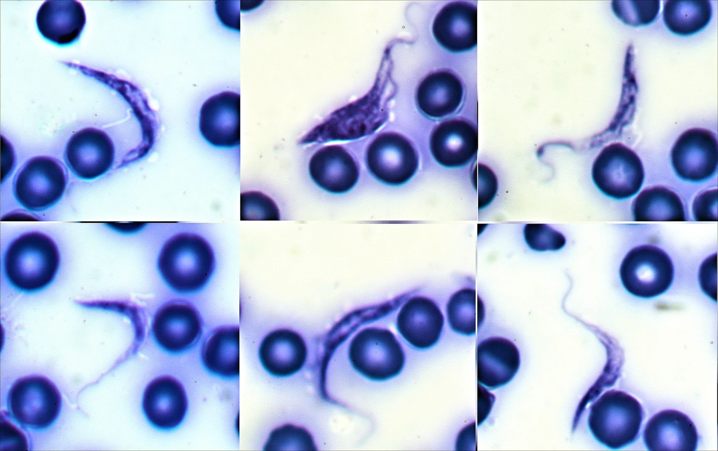 The worm-like Trypanosoma cruzi parasite among blood cells