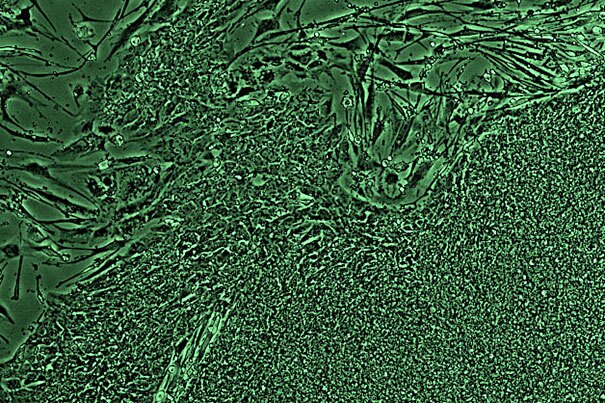 Human induced pluripotent stem cells
