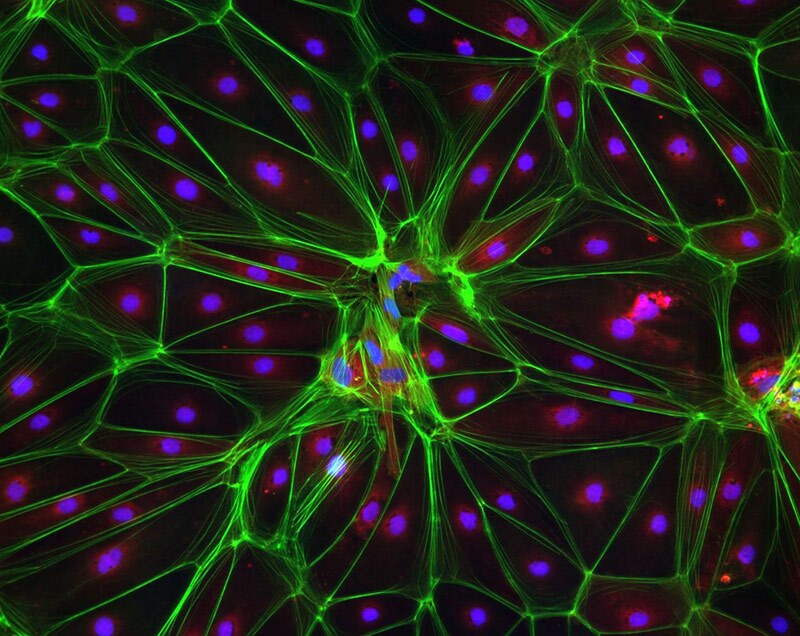 Anushree Balachandran of Genea, Sydney, won the high-content analysis category with this image of a Huntington's disease stem cell