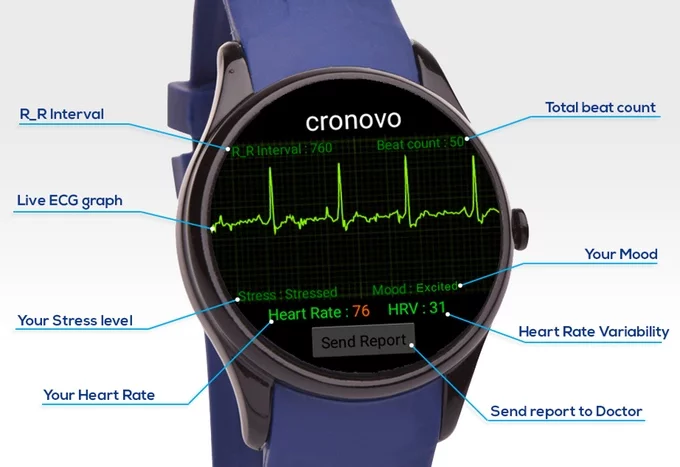 The EKG on the Cronovo
