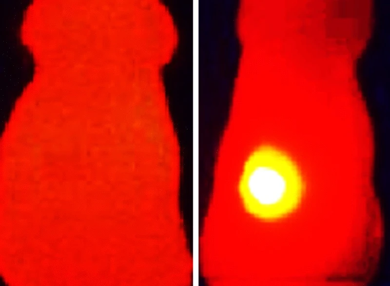 An infrared image of a tumor injected with melanin-loaded nanoparticles (right), compared to one that had just nanoparticles with no melanin (left)
