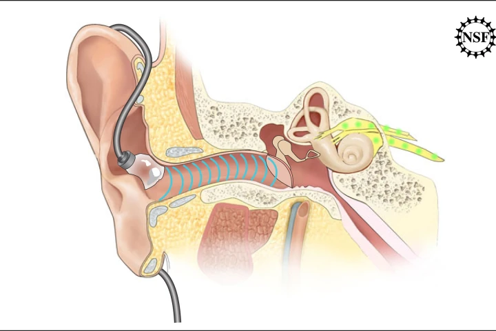 The ADEL features an inflatable tip, that is said to minimize or eliminate discomfort in the ears of music listeners (All images: Asius Technologies)