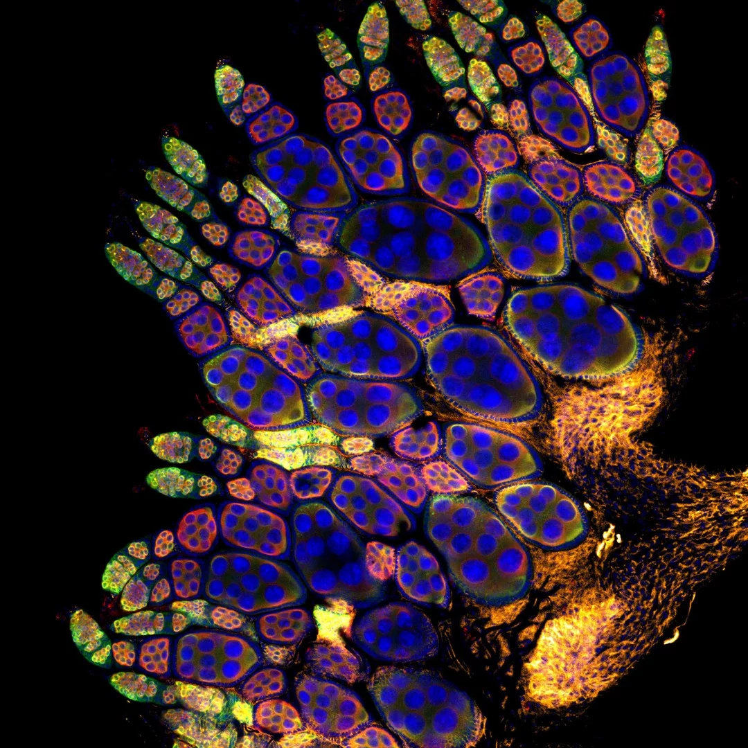 Image of Distinction: Fruit fly ovary from a young adult